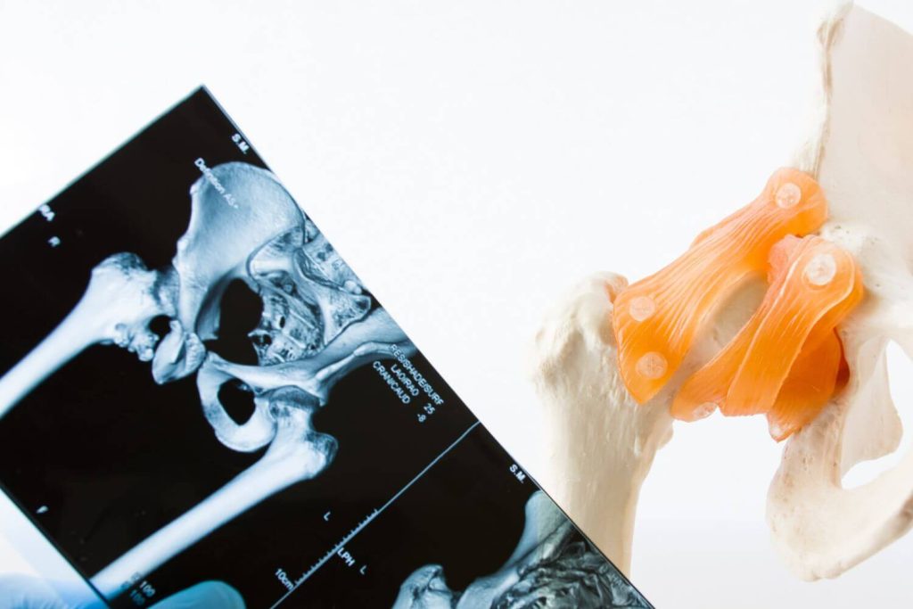 Ortopedista pediatra en CDMX