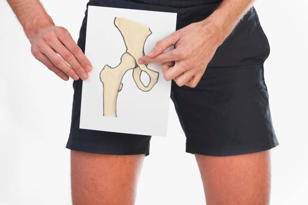atamiento Epifisiolistesis Femoral Proximalen CDMX